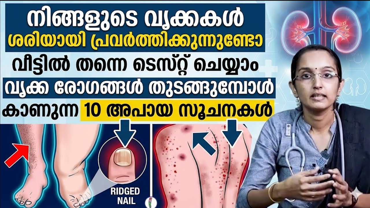 വൃക്ക രോഗങ്ങൾ തുടങ്ങുമ്പോൾ ശരീരത്തിൽ കാണുന്ന 10 അപായ സൂചനകൾ | vrikka rogam malayalam