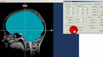 BrainVoyager QX - tutorial1 - brainpeeling.avi