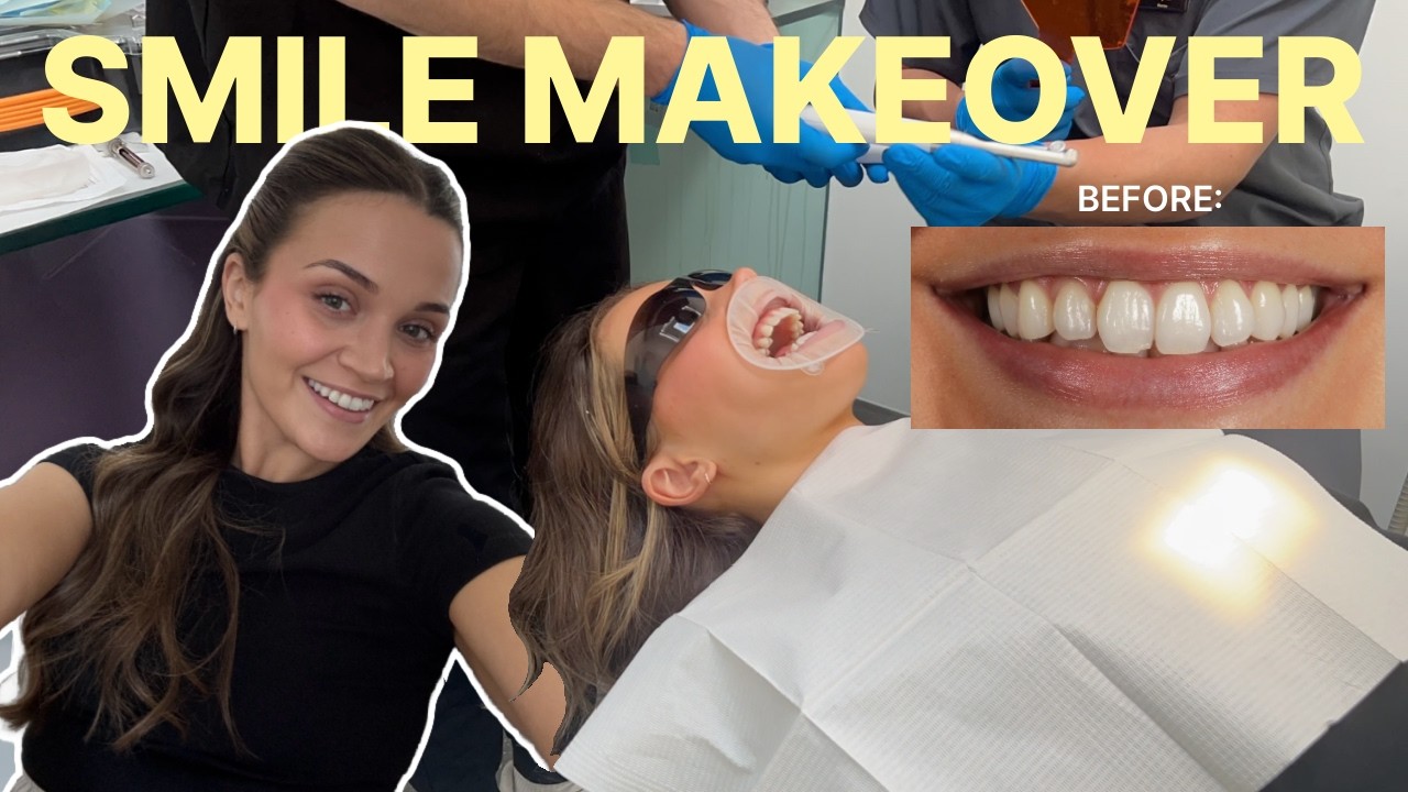 TEETH TRANSFORMATION... I got Composite Bonding! | VLOG