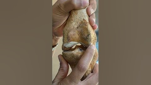 video showing locking of knee joint at the end of extension