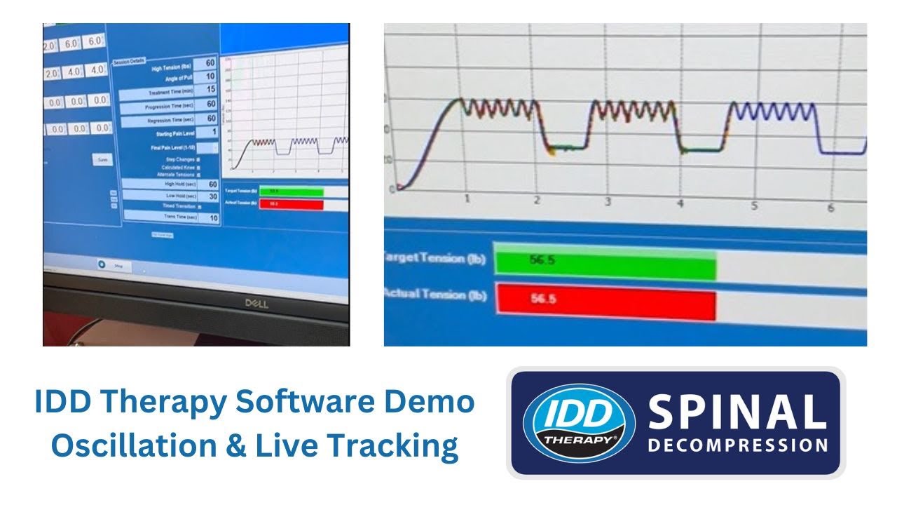 Spinal Decompression Software Demo - IDD Therapy Oscillation, Cycles and Time Under Tension