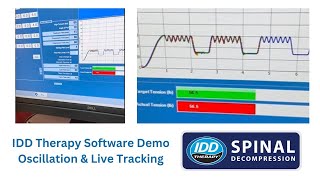 Spinal Decompression Software Demo - Idd Therapy Oscillation, Cycles And Time Under Tension