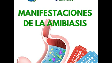 ¿Cómo sé si tengo una ameba?