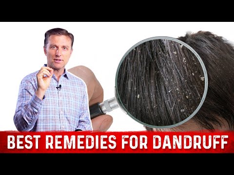 Best Remedies for Dandruff