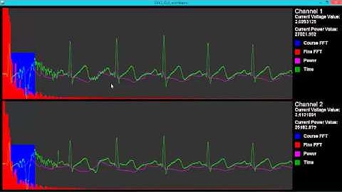 EMG/EKG Demo - ECE495 Project