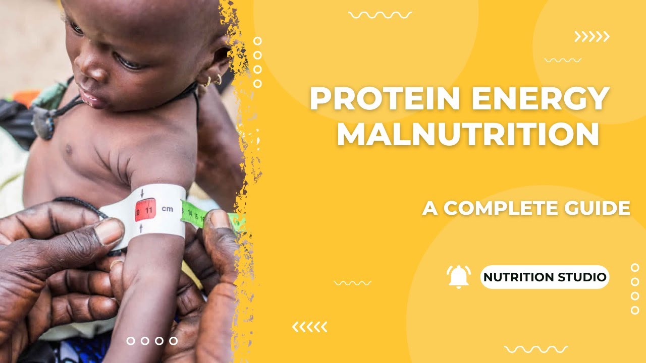 Protein Energy Malnutrition (A Guide) YouTube