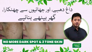 No more Dark Spots & Two Tone Skin | Pigmentation treatment at home | Dark Spots on Face Removal