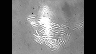 Myxococcus Xanthus gliding motility (on TPM Agar)