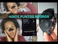 black  head /como quitar puntos negros