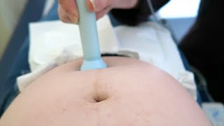 HEARING BABY'S HEARTBEAT!