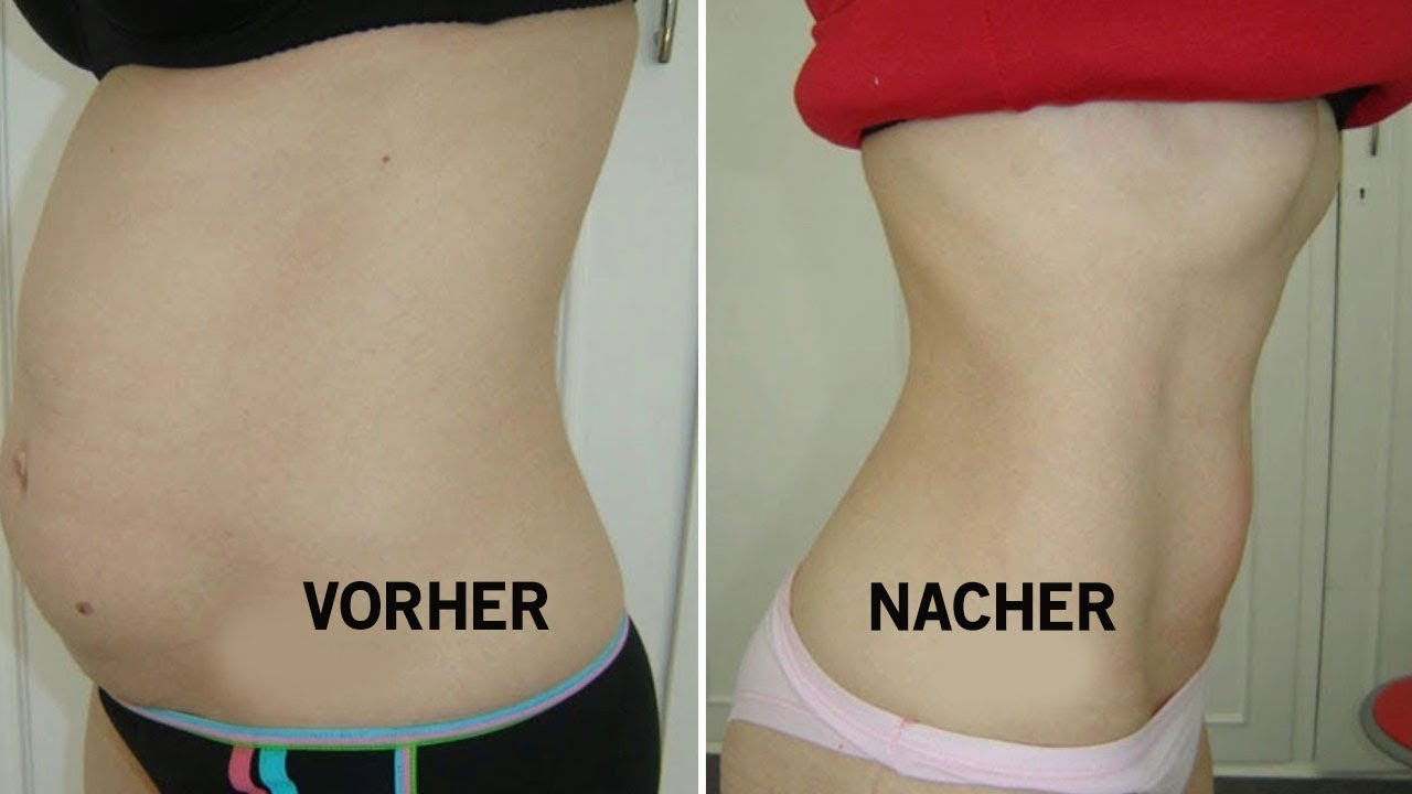 Honig und Zimt, um schnell Gewicht zu verlieren