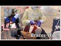 Exciting Orthodontist Appointment | Braces Vlog!