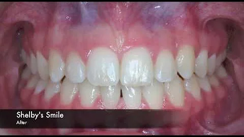 Make a Hechler Orthodontics Smile