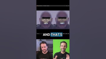 From Bite Record to CBCT Precision