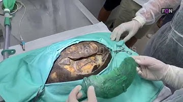FocusOn News   Vets in Brazil repair badly damaged tortoise shell with 3D printed prosthesis