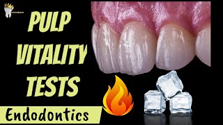 ENDODONTICS | PULP VITALITY TESTS MADE EASY !!!