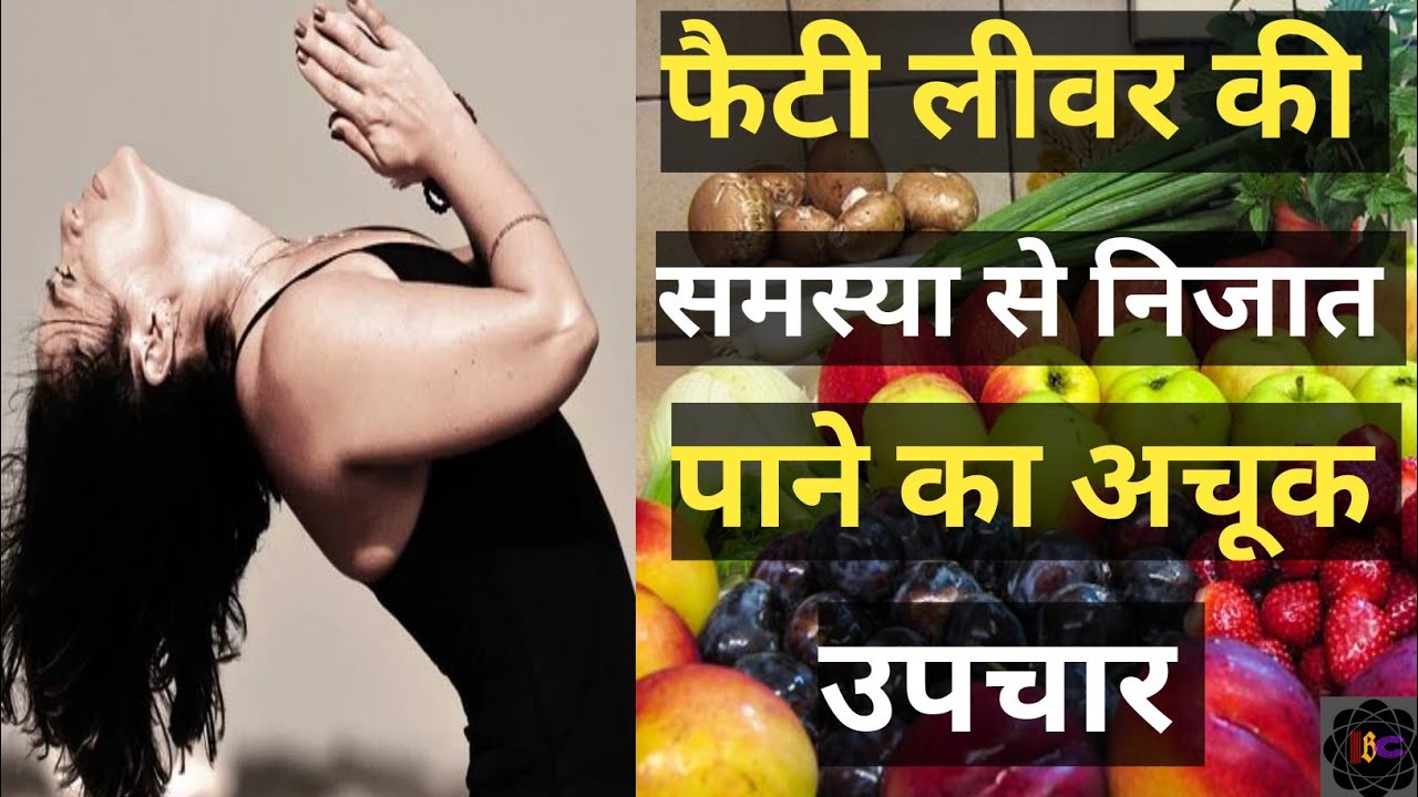 How To Treat Fatty Liver Naturally At Home। फैटी लीवर से निजात पाने का