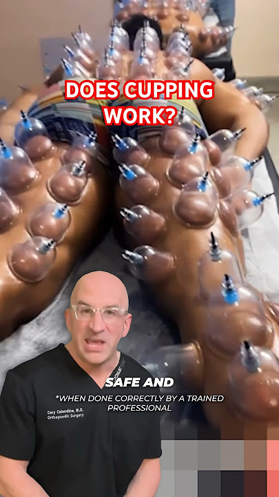 Cupping Therapy - Pain Relief or Nonsense⁉️ #shorts