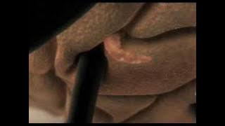 Combantrin PetakUmpet 480