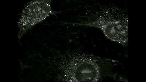 Tumor-derived extracellular vesicles uptake in mouse brain endothelial cells