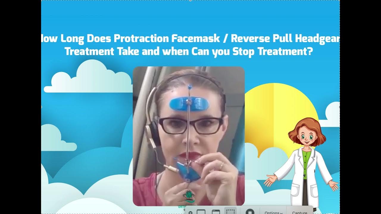 Treatment Duration for Reverse Pull Headgear Protraction Facemask YouTube