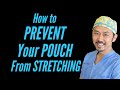 Prevent Pouch Stretching: Dr. V's 8 Step Eating Method for WLS Patients