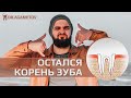 От зуба остался корень. Как восстановить? Что делать?