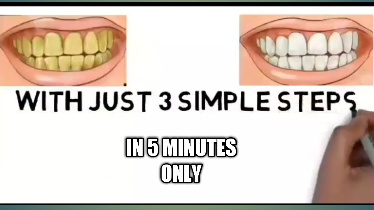 HOW TO RID OF YELLOW TEETH IN JUST 5 MINUTES YouTube how-to-rid-of-yellow-teeth-in-just-5-minutes-youtube