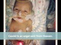 22 Week Miracle Baby Cassiel