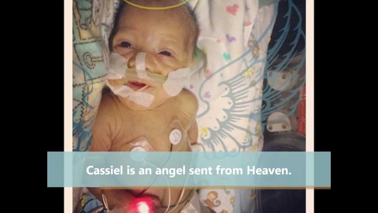 'Miracle baby': Born at 21 weeks, she may be the most premature surviving infant
