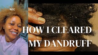 GOODBYE DANDRUFF : REVEALING THE SINGLE PRODUCT THAT SAVED MY HAIR☺️