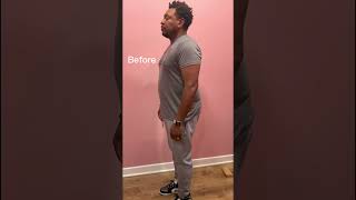 Before &amp; After Weight Loss Transformation with  Semaglutide at GlamDrChicago Medspa #semaglutide