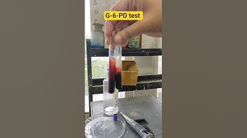G-6-PD test- use to detect the deficiency of g6pd enzyme.