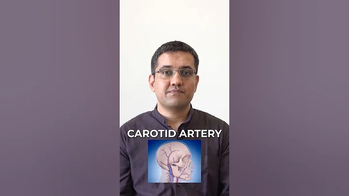Treatment for Carotid Artery Issues 🤯