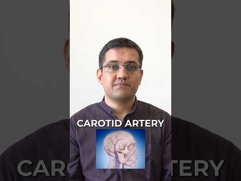 Video: Is karotis arterie stenting veilig?