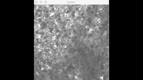 CaImAn Calcium Imaging Analysis  motion correction 2/3