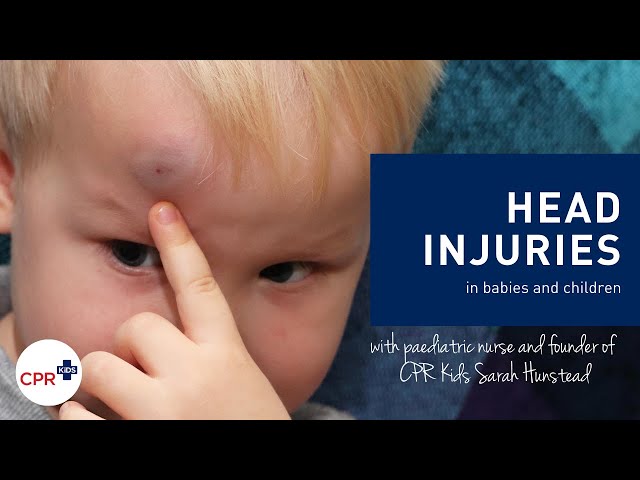 Head Injuries In Babies And Children