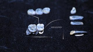 Teeth of new human ancestor discovered in Ethiopia