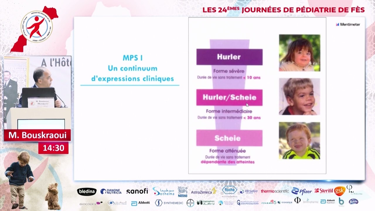 La Mucopolysaccharidose type I : Quand y penser et comment la traiter : M.  Bouskraoui : Marrakech