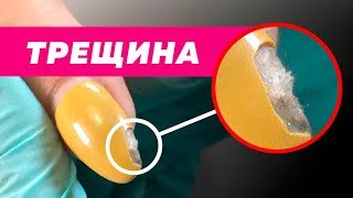 видео: Почему нельзя перекрывать трещины | Правильный ремонт сломанного ногтя | Оксана Глинская картинка: Почему нельзя перекрывать трещины | Правильный ремонт сломанного ногтя | Оксана Глинская