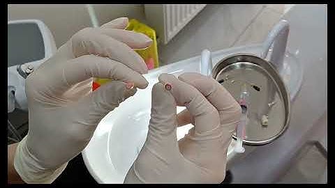 Endodontic Step-by-Step Tutorial for Beginners | Working Length, Step-Back, Lateral Condensation