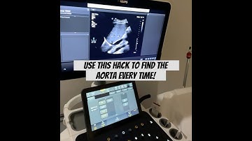 Struggling to See the Aorta? Try THIS Hack! #aorta #ultrasound #vascularsystem #sonography