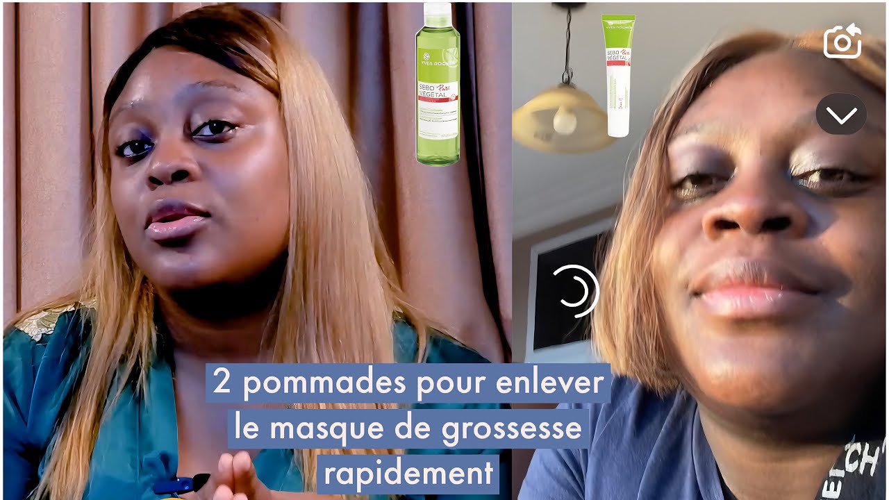 Comment Faire Partir Le Masque De Grossesse Recette Maison