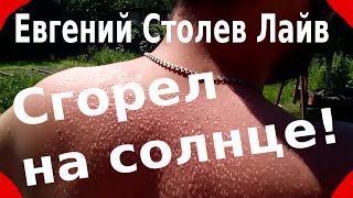 2016_06_18 - сгорел на солнце