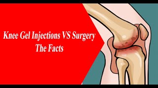 NYC Pain MD Knee Gel Injections vs Surgery Facts