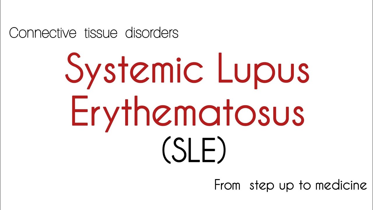 SLE ( Systemic Lupus Erythematosus ) Kmu Medicine lecture Urdu
