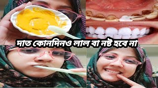 ৩ মিনিটে দাতের কঠিন দাগ দূর করে দাত হবে মুক্তার মতো চকচকে গ্যারান্টি। Teeth Whitening at Home screenshot 5