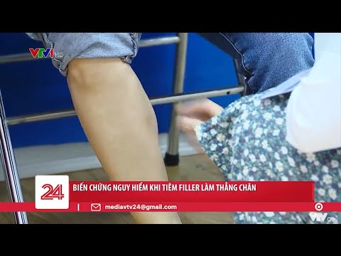 Video Tiêm filler làm thẳng chân, chân chưa kịp thẳng thì đã... - youtube