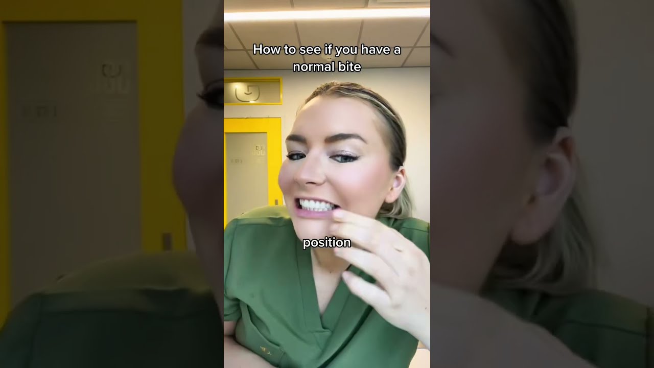 Class 1 Bite Is Ideal Did You Have This Teeth Braces Fyp