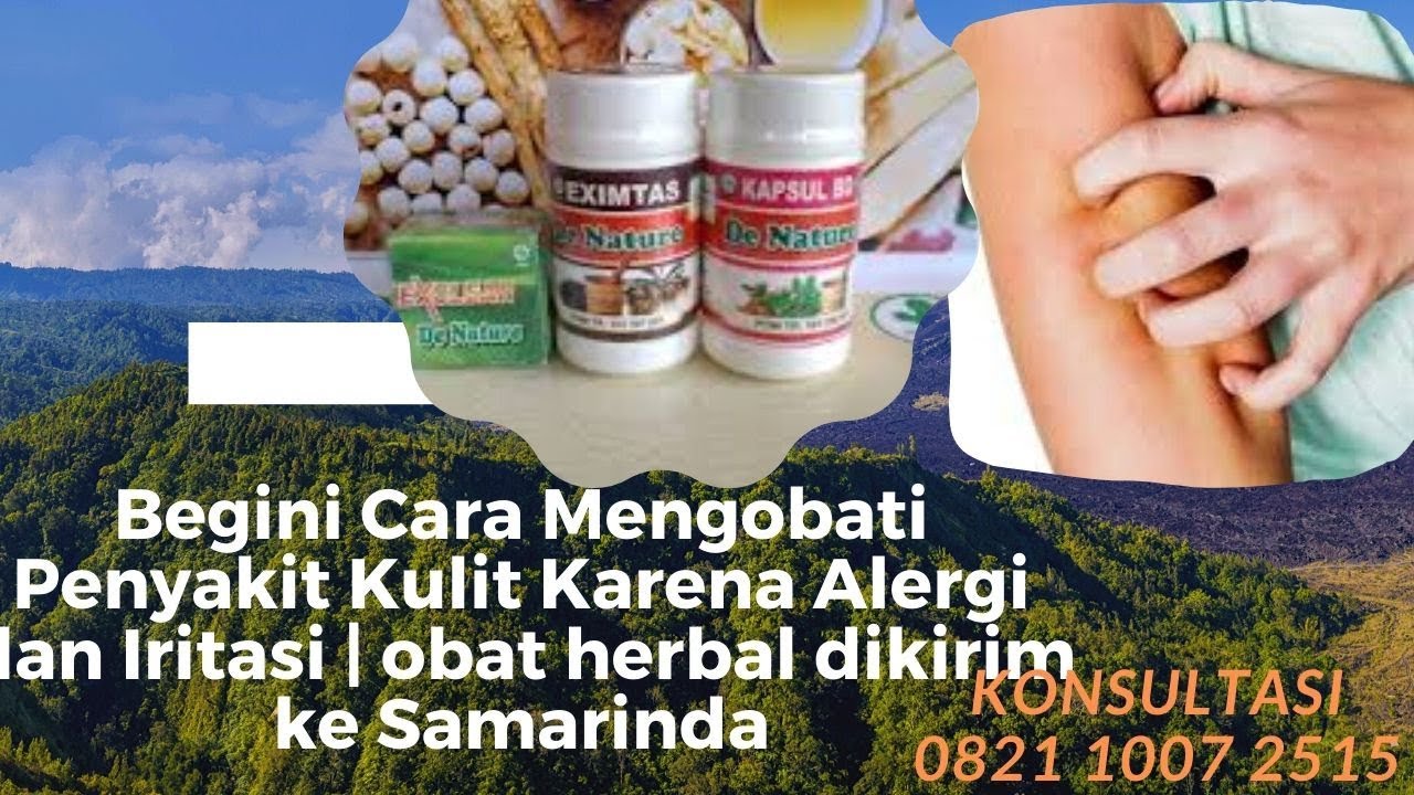 Begini Cara Mengobati Penyakit Kulit Karena Alergi dan Iritasi | obat